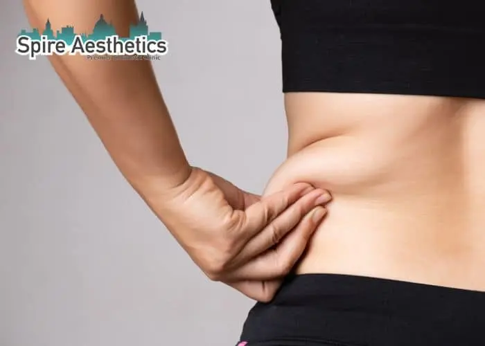 Image of woman pinching fat on their hips Thatcham. Fat Freezing treatment