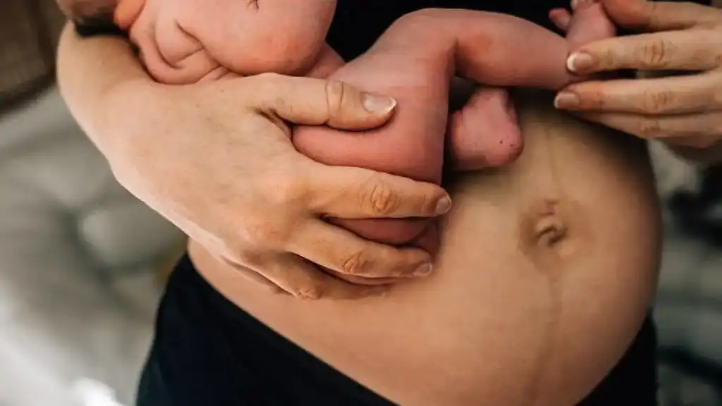Why Is My Stomach Still Big After Pregnancy Thatcham?